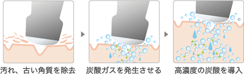 メディアクアプロ　大阪　ハイドラ毛穴洗浄